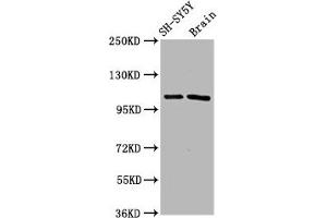 Western Blot Positive WB detected in: SH-SY5Y whole cell lysate, Rat brain tissue All lanes: FBXO10 antibody at 4. (Cyclin F 抗体  (AA 248-400))