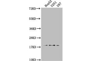 Western Blot Positive WB detected in: HepG2 whole cell lysate, U251 whole cell lysate, U87 whole cell lysate All lanes: ARL2BP antibody at 1:1000 Secondary Goat polyclonal to rabbit IgG at 1/50000 dilution Predicted band size: 19, 18 kDa Observed band size: 19 kDa (ARL2BP 抗体  (AA 1-163))