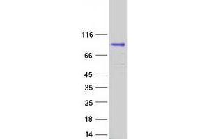 Western Blotting (WB) image for Dihydrouridine Synthase 3-Like (DUS3L) protein (Myc-DYKDDDDK Tag) (ABIN2719820)