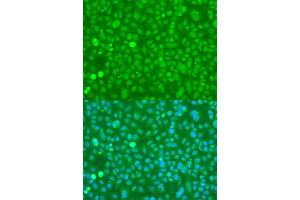 Immunofluorescence analysis of U2OS cells using UBC antibody. (UBC 抗体  (AA 1-100))
