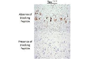Immunohistochemistry analysis of a competition assay demonstrating the specificity of the anti-Tau (Thr-217) antibody (tau 抗体  (pThr217))