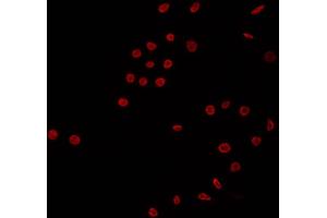 ABIN6266681 staining K562 by IF/ICC. (NK6 Homeobox 3 抗体  (Internal Region))