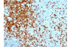 Formalin-fixed, paraffin-embedded human Tonsil stained with CD43 Mouse Monoclonal Antibody (84-3C1). (CD43 抗体)