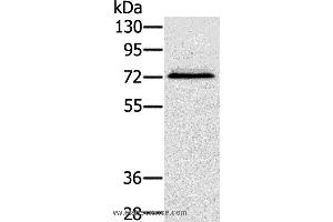 Western blot analysis of Hepg2 cell, using SSX2IP Polyclonal Antibody at dilution of 1:500