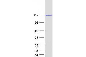 Western Blotting (WB) image for CCR4-NOT Transcription Complex, Subunit 3 (CNOT3) protein (Myc-DYKDDDDK Tag) (ABIN2712910)