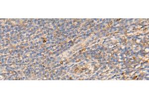 Immunohistochemistry of paraffin-embedded Human tonsil tissue using PDIA5 Polyclonal Antibody at dilution of 1:50(x200) (PDIA5 抗体)
