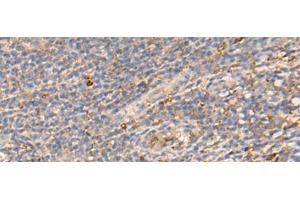 Immunohistochemistry of paraffin-embedded Human tonsil tissue using PDIA5 Polyclonal Antibody at dilution of 1:50(x200) (PDIA5 抗体)