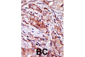 Immunohistochemistry (IHC) image for anti-KIP2 antibody (ABIN3003730) (KIP2 抗体)