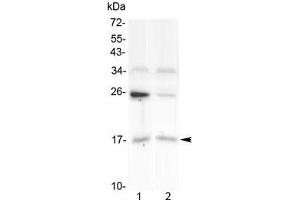 Western blot testing of human 1) U-87 MG and 2) placenta lysate with IL1F10 antibody at 0. (IL1F10 抗体)