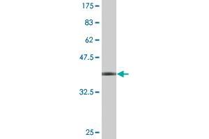 Western Blotting (WB) image for anti-WD Repeat Containing, Antisense To TP53 (WRAP53) (AA 62-160) antibody (ABIN527367)