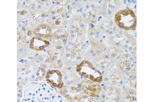 Immunohistochemistry of paraffin-embedded Rat kidney using RNASEL Polyclonal Antibody at dilution of 1:100 (40x lens). (RNASEL 抗体)