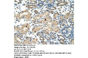 Human kidney (DMRT2 抗体  (N-Term))