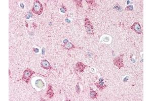 Human Brain, Cortex (formalin-fixed, paraffin-embedded) stained with GPR44at 5 µg/ml followed by biotinylated goat anti-rabbit IgG secondary antibody, alkaline phosphatase-streptavidin and chromogen.