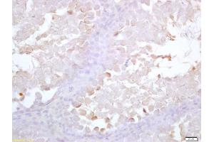 Formalin-fixed and paraffin embedded rat testis labeled with Anti-Acrosin Polyclonal Antibody, Unconjugated (ABIN1387665) at 1:200 followed by conjugation to the secondary antibody and DAB staining (Acrosin 抗体  (AA 201-300))