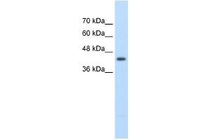 UPB1 antibody used at 2. (UPB1 抗体  (Middle Region))