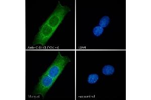 ABIN238557 Immunofluorescence analysis of paraformaldehyde fixed MCF7 cells, permeabilized with 0.