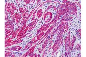 Human Uterus: Formalin-Fixed, Paraffin-Embedded (FFPE) (ACTG2 抗体  (N-Term))