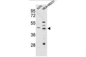 Western blot analysis of CTSD Antibody (C-term) in A375, MDA-MB231 cell line lysates (35µg/lane). (Cathepsin D 抗体  (C-Term))