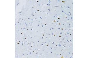 Immunohistochemistry of paraffin-embedded rat heart using SNRNP70 antibody. (SNRNP70 抗体  (AA 150-250))