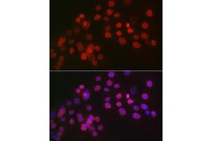 Immunofluorescence analysis of OVCAR-3 cells using WT1 Rabbit pAb (ABIN7271369) at dilution of 1:100 (40x lens). (WT1 抗体  (AA 1-302))