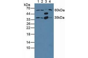 Figure. (GNB2 抗体  (AA 2-340))