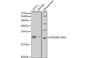Western blot analysis of extracts of various cell lines, using PSMB9/LMP2 antibody (ABIN3022517, ABIN3022518, ABIN3022519 and ABIN6218874) at 1:1000 dilution. (PSMB9 抗体  (AA 1-219))