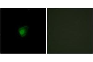Immunofluorescence analysis of HepG2 cells, using SMG7 Antibody. (SMG7 抗体  (AA 521-570))