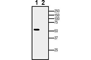 anti-Adiponectin Receptor 1 (ADIPOR1) (AA 18-31), (Intracellular), (N-Term) antibody