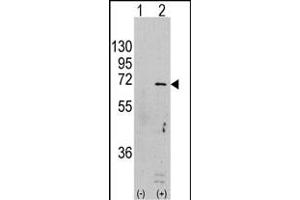 Western blot analysis of PRK (arrow) using rabbit polyclonal PRK Antibody  (ABIN391388 and ABIN2837970). (AMPK alpha 抗体  (AA 474-502))