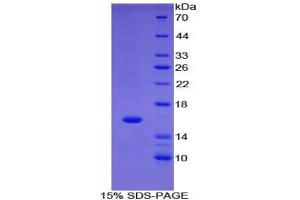 SDS-PAGE of Protein Standard from the Kit (Highly purified E. (FABP1 ELISA 试剂盒)