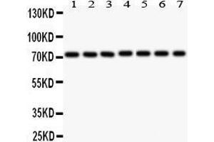 Anti- SDHA Picoband antibody, Western blotting All lanes: Anti SDHA  at 0.