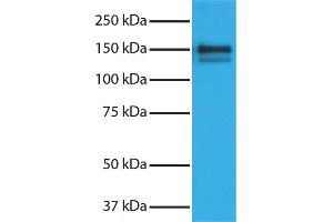 Purified Human Type I Collagen secondary antibody and chemiluminescent detection. (驴 anti-山羊 IgG (Heavy & Light Chain) Antibody (HRP) - Preadsorbed)