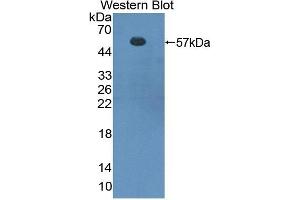 Detection of Recombinant FOXP3, Mouse using Polyclonal Antibody to Forkhead Box P3 (FOXP3) (FOXP3 抗体  (AA 190-412))
