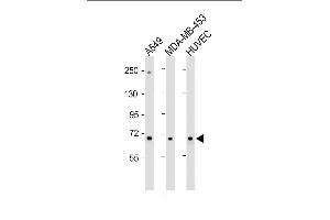 All lanes : Anti-COL8A1 Antibody (N-term) at 1:1000 dilution Lane 1: A549 whole cell lysate Lane 2: MDA-MB-453 whole cell lysate Lane 3: HUVEC whole cell lysate Lysates/proteins at 20 μg per lane. (COL8A1 抗体  (N-Term))