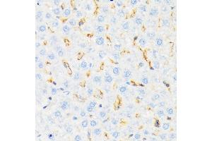 Immunohistochemistry of paraffin-embedded rat liver using CSK Rabbit mAb (ABIN1513217, ABIN3021034, ABIN3021035 and ABIN7101334) at dilution of 1:100 (40x lens). (CSK 抗体)