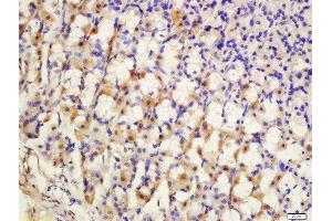 Formalin-fixed and paraffin embedded rat stomach labeled with Anti-SCN7A Polyclonal Antibody, Unconjugated  at 1:200 followed by conjugation to the secondary antibody and DAB staining. (SCN7A 抗体  (AA 1561-1582))