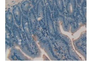 IHC-P analysis of Mouse Intestine Tissue, with DAB staining. (Retinoic Acid Receptor alpha 抗体  (AA 237-459))