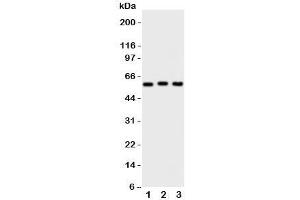 Western blot testing of PKM2 antibody and Lane 1:  HeLa;  2: MCF-7;  3: A549 cell lysate (PKM2 抗体  (N-Term))