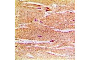 Immunohistochemical analysis of Frataxin staining in rat heart formalin fixed paraffin embedded tissue section. (Frataxin 抗体)