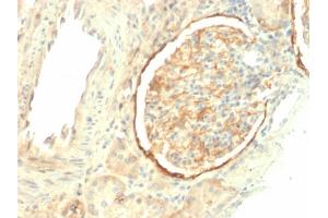 Formalin-fixed, paraffin-embedded human Kidney stained with CD61 Mouse Monoclonal Antibody (ITGB3/2145). (Integrin beta 3 抗体  (AA 385-490))