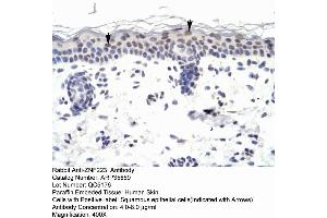 Human Skin (ZNF223 抗体  (N-Term))