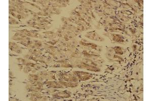 Paraformaldehyde-fixed, paraffin embedded Mouse stomach; Antigen retrieval by boiling in sodium citrate buffer (pH6. (MTM1 抗体  (AA 225-275))