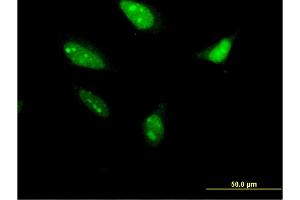 Immunofluorescence of monoclonal antibody to RNF212 on HeLa cell. (RNF212 抗体  (AA 133-232))