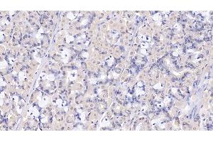 Detection of SELP in Human Stomach Tissue using Polyclonal Antibody to P-Selectin (SELP) (P-Selectin 抗体  (AA 58-195))