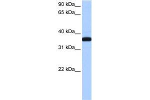 WB Suggested Anti-THEX1 Antibody Titration: 0. (ERI1 抗体  (N-Term))