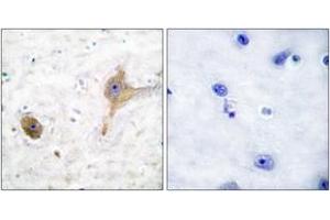 Immunohistochemistry analysis of paraffin-embedded human brain tissue, using GABA-B Receptor Antibody. (GABBR1 抗体  (AA 871-920))