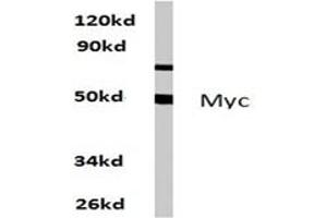 Image no. 1 for anti-Myc Proto-Oncogene protein (MYC) antibody (ABIN271737) (c-MYC 抗体)