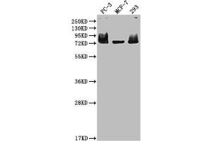 Western Blot Positive WB detected in: PC-3 whole cell lysate, MCF-7 whole cell lysate, 293 whole cell lysate All lanes: MEN1 antibody at 1:2000 Secondary Goat polyclonal to rabbit IgG at 1/50000 dilution Predicted band size: 69, 68, 64 kDa Observed band size: 75 kDa (Recombinant Menin 抗体)