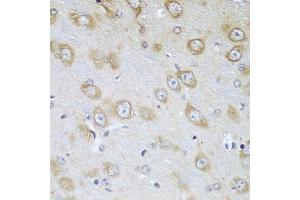 Immunohistochemistry of paraffin-embedded mouse brain using TMOD3 antibody at dilution of 1:100 (40x lens). (TMOD3 抗体)