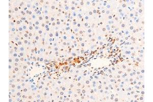 ABIN6256552 and ABIN6267251 at 1/100 staining rat liver tissue sections by IHC-P. (CHEK2 抗体  (pThr383))
